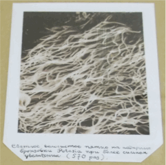 Светлое волосистое пятно на надкрылье бронзовки Potosia при более сильном увеличении (570 раз)
