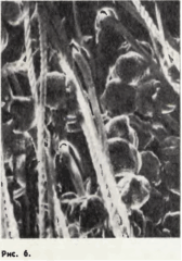 Рис. 6. Участок брюшной пыльцесобирательной щетки одиночной пчелы осмии (Osmia sp. Megachilidae), увеличенной в 450 раз. Видны пыльцевые зерна, густо набившиеся между длинными спиральными пыльцезадерживающими волосками.