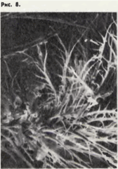 Рис. 8. Ветвистые волоски в основании пятки рабочего шмеля Bombus lucorum. при увеличении в 230 раз (сравните со снимком аналогичного участка ноги медоносной пчелы, рис. 2).